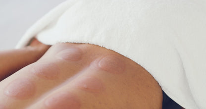 Sistema di Coppettazione Smart