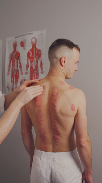 Set per Coppettazione Smart